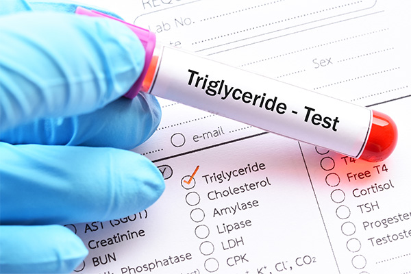 Triglycerides- test