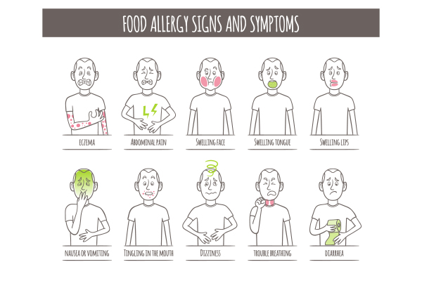 food allergies signs and symptoms